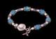 Ovarian Cancer Awareness